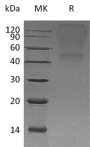 BL-0439NP: Greater than 95% as determined by reducing SDS-PAGE. (QC verified)Recombinant Human BGN Protein (C-6His)