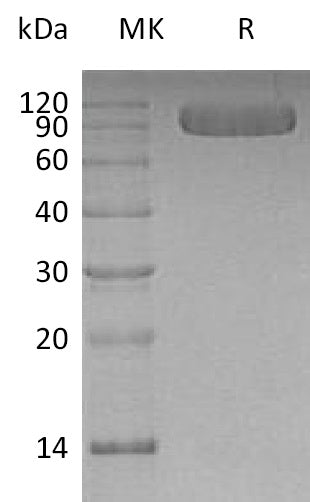 BL-0445NP: Greater than 95% as determined by reducing SDS-PAGE. (QC verified)Recombinant Human Vasorin Protein (C-6His)
