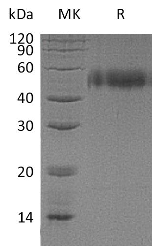 BL-0437NP: Greater than 95% as determined by reducing SDS-PAGE. (QC verified)Recombinant Human uPAR Protein (C-6His)