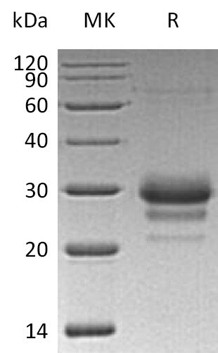 BL-0442NP: Greater than 95% as determined by reducing SDS-PAGE. (QC verified)Recombinant Human TFPI-2 Protein (C-6His)