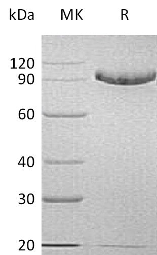 BL-0451NP: Greater than 95% as determined by reducing SDS-PAGE. (QC verified)Recombinant Human C1q R1 Protein (C-6His)