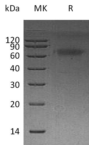 BL-0452NP: Greater than 95% as determined by reducing SDS-PAGE. (QC verified)Recombinant Human DKK-3 Protein (C-6His)