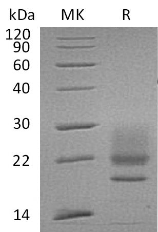 BL-0449NP: Greater than 95% as determined by reducing SDS-PAGE. (QC verified)Recombinant Human CD83 Protein (C-6His)
