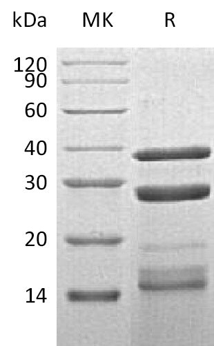 BL-2240NP: Greater than 90% as determined by reducing SDS-PAGE. (QC verified)Recombinant Human CTSS Protein (C-6His)