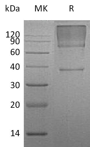 BL-1214NP: Greater than 95% as determined by reducing SDS-PAGE. (QC verified)