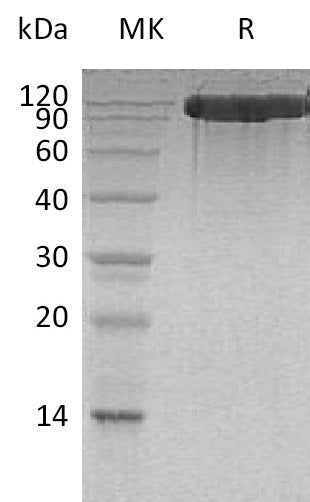 BL-0315NP: Greater than 95% as determined by reducing SDS-PAGE. (QC verified)Recombinant Human ACE-2 Protein (C-6His)