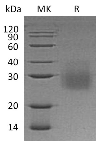 BL-0454NP: Greater than 95% as determined by reducing SDS-PAGE. (QC verified)Recombinant Human HVEM Protein (C-6His)
