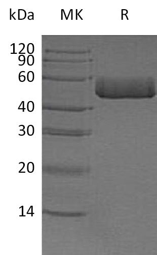 BL-1334NP: Greater than 95% as determined by reducing SDS-PAGE. (QC verified)Recombinant Human ACPP Protein (C-6His)
