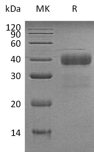 BL-1333NP: Greater than 95% as determined by reducing SDS-PAGE. (QC verified)Recombinant Human KLK5 Protein (C-6His)