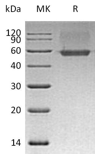 BL-0456NP: Greater than 95% as determined by reducing SDS-PAGE. (QC verified)Recombinant Human AGER Protein (C-6His)