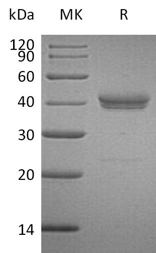 BL-0466NP: Greater than 95% as determined by reducing SDS-PAGE. (QC verified)Recombinant Human CADM3 Protein (C-6His)