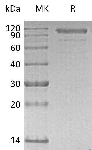 BL-0465NP: Greater than 90% as determined by reducing SDS-PAGE. (QC verified)Recombinant Human CDH6 Protein (C-6His)