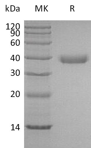 BL-0461NP: Greater than 95% as determined by reducing SDS-PAGE. (QC verified)Recombinant Human Azurocidin Protein (C-6His)