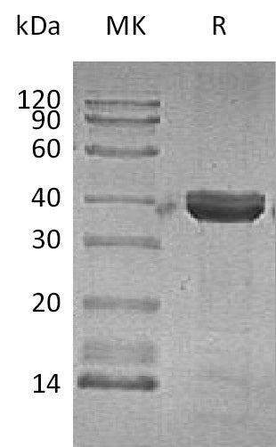 BL-1337NP: Greater than 95% as determined by reducing SDS-PAGE. (QC verified)Recombinant Human CTSZ Protein (C-6His)