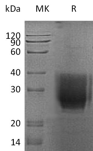BL-2556NP: Greater than 95% as determined by reducing SDS-PAGE. (QC verified)Recombinant Human EMMPRIN Protein (C-6His)