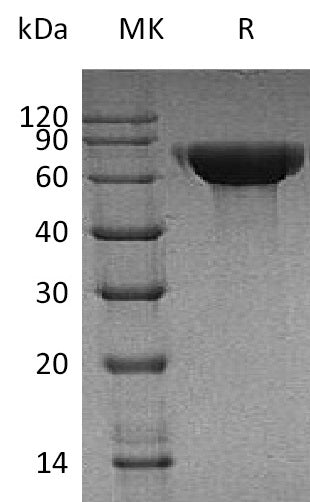 BL-1336NP: Greater than 95% as determined by reducing SDS-PAGE. (QC verified)Recombinant Human CNDP1 Protein (C-6His)