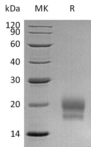 BL-0474NP: Greater than 95% as determined by reducing SDS-PAGE. (QC verified)Recombinant Human CEACAM3 Protein (C-6His)