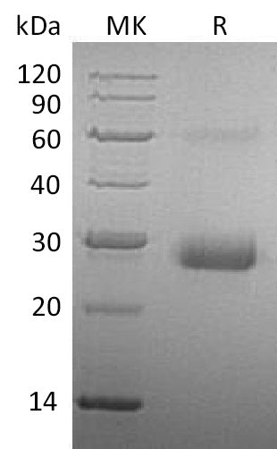 BL-0478NP: Greater than 95% as determined by reducing SDS-PAGE. (QC verified)Recombinant Human TIMP-1 Protein (C-6His)