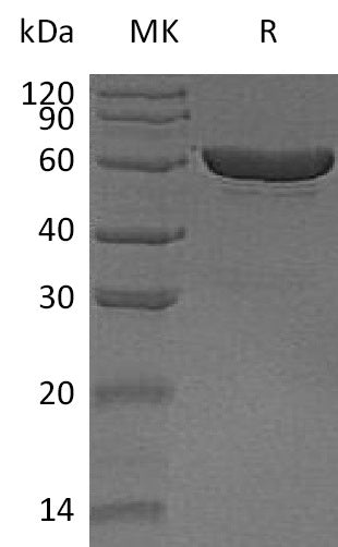 BL-1338NP: Greater than 95% as determined by reducing SDS-PAGE. (QC verified)Recombinant Human CES1 Protein (C-6His)
