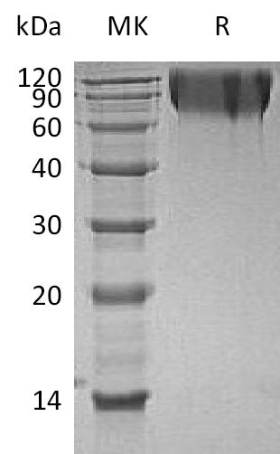 BL-0473NP: Greater than 95% as determined by reducing SDS-PAGE. (QC verified)Recombinant Human CEACAM1 Protein (C-6His)