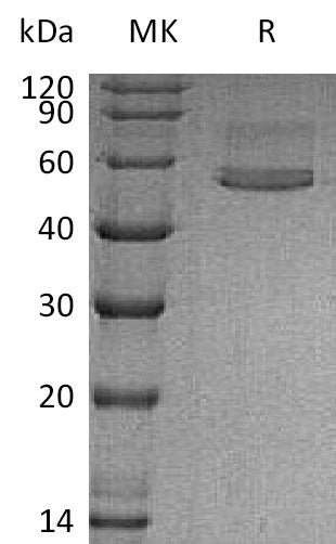 BL-1339NP: Greater than 95% as determined by reducing SDS-PAGE. (QC verified)Recombinant Human CHIT1 Protein (C-6His)