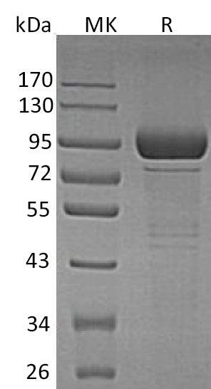 BL-1343NP: Greater than 95% as determined by reducing SDS-PAGE. (QC verified)Recombinant Human GLB1 Protein (C-6His)