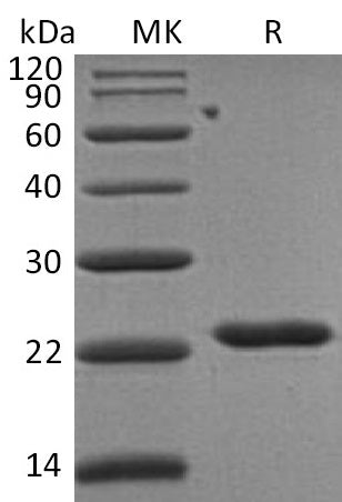 BL-0480NP: Greater than 95% as determined by reducing SDS-PAGE. (QC verified)Recombinant Human TIMP-2 Protein (C-6His)
