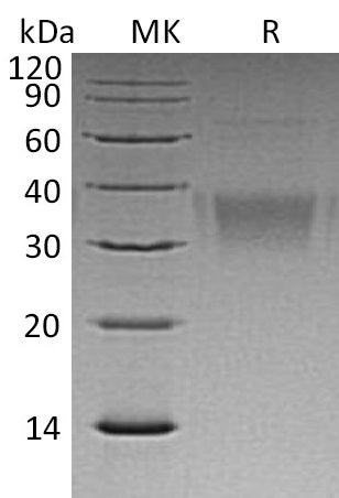 BL-1224NP: Greater than 95% as determined by reducing SDS-PAGE. (QC verified)Recombinant Human EFNB2 Protein (C-6His)