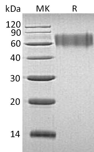 BL-1226NP: Greater than 95% as determined by reducing SDS-PAGE. (QC verified)Recombinant Human LYPD3 Protein (C-6His)