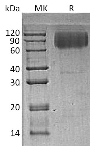 BL-0325NP: Greater than 95% as determined by reducing SDS-PAGE. (QC verified)Recombinant Human LAMP2 Protein (C-6His)