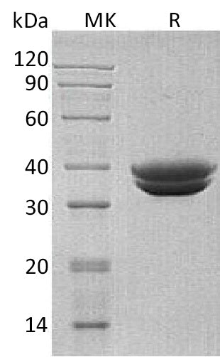 BL-0491NP: Greater than 95% as determined by reducing SDS-PAGE. (QC verified)Recombinant Human GPA33 Protein (C-6His)