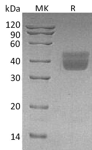 BL-1344NP: Greater than 95% as determined by reducing SDS-PAGE. (QC verified)Recombinant Human KLK1 Protein (C-6His)