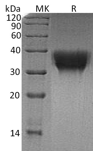BL-0510NP: Greater than 95% as determined by reducing SDS-PAGE. (QC verified)Recombinant Human TREM-1 Protein (C-6His)