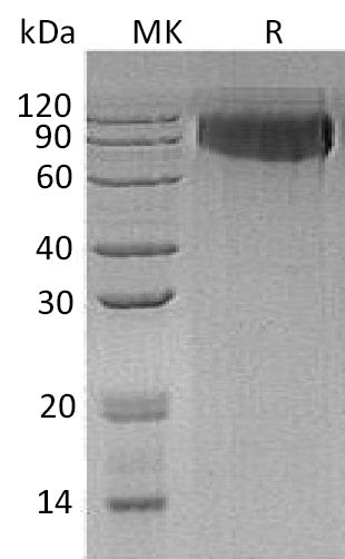 BL-0505NP: Greater than 95% as determined by reducing SDS-PAGE. (QC verified)Recombinant Human GPNMB Protein (C-6His)
