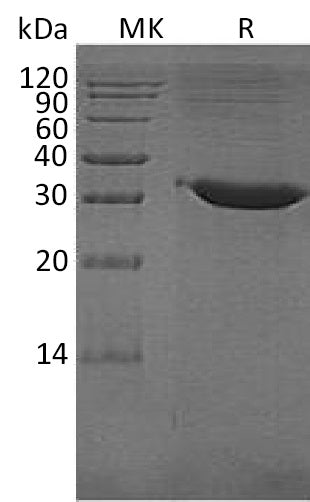 BL-1348NP: Greater than 95% as determined by reducing SDS-PAGE. (QC verified)Recombinant Human TPSB2 Protein (C-6His)