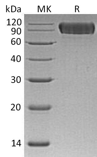 BL-0501NP: Greater than 95% as determined by reducing SDS-PAGE. (QC verified)Recombinant Human NLGN1 Protein (C-6His)