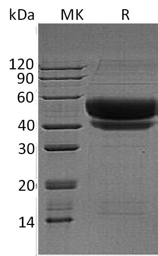 BL-1346NP: Greater than 95% as determined by reducing SDS-PAGE. (QC verified)Recombinant Human ST6GAL1 Protein (C-6His)