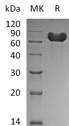 BL-2630NP: Greater than 95% as determined by reducing SDS-PAGE. (QC verified)Recombinant Human GOLM1 Protein (C-6His)