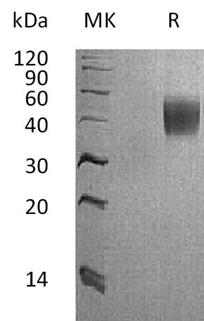 BL-1209NP: Greater than 95% as determined by reducing SDS-PAGE. (QC verified)Recombinant Cynomolgus IL-4RA Protein (C-6His)
