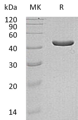 BL-1399NP: Greater than 95% as determined by reducing SDS-PAGE. (QC verified)Recombinant Human IDH1 Protein (C-6His,Mammalian)