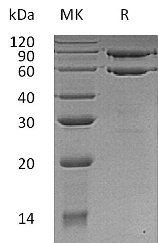 BL-0650NP: Greater than 95% as determined by reducing SDS-PAGE. (QC verified)Recombinant Human COL8A1 Protein (C-6His)