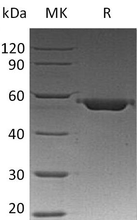 BL-0656NP: Greater than 95% as determined by reducing SDS-PAGE. (QC verified)Recombinant Human VDB Protein (C-6His)