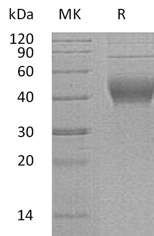 BL-2894NP: Greater than 95% as determined by reducing SDS-PAGE. (QC verified)Recombinant Human IL-22RA2 Protein (C-6His)