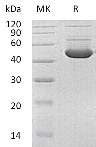 BL-0652NP: Greater than 90% as determined by reducing SDS-PAGE. (QC verified)Recombinant Human HMBS Protein (C-6His)