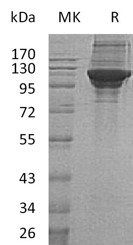 BL-1389NP: Greater than 95% as determined by reducing SDS-PAGE. (QC verified)Recombinant Human KARS Protein (C-6His)