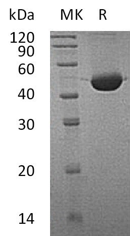 BL-0631NP: Greater than 95% as determined by reducing SDS-PAGE. (QC verified)Recombinant Human FAH Protein (C-6His)