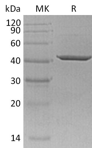 BL-1393NP: Greater than 95% as determined by reducing SDS-PAGE. (QC verified)Recombinant Human SORD Protein (C-6His)