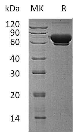 BL-1395NP: Greater than 95% as determined by reducing SDS-PAGE. (QC verified)Recombinant Human MAN1B1 Protein (C-6His)