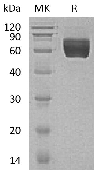 BL-1394NP: Greater than 95% as determined by reducing SDS-PAGE. (QC verified)Recombinant Human GALNTL1 Protein (C-6His)