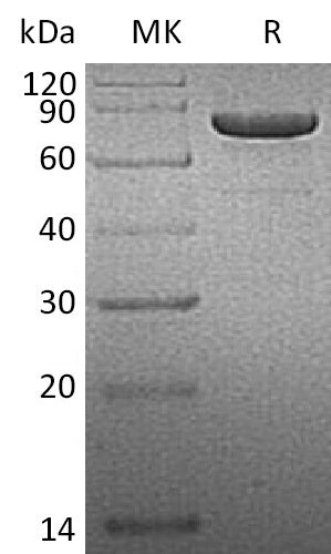 BL-1397NP: Greater than 95% as determined by reducing SDS-PAGE. (QC verified)Recombinant Human PRKG1 Protein (C-6His)